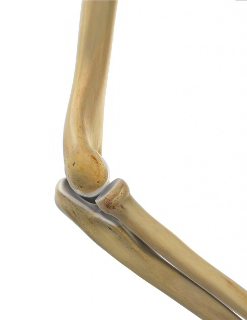 В сложном по строению локтевом суставе соединены три кости. Плечевая кость (Humerus) соединяется с локтевой (ulna) и лучевой (radius) костью предплечья. Нередко, выступающий снизу отросток локтевой кости (Olecranon) называется локтем. Гибкое сочленение трех костей, окруженное одной суставной капсулой, называется локтевым суставом. 