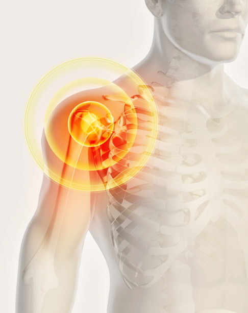Боль в плече появляется по разным, схожим по симптоматике причинам. Специализированное обследование болевого синдрома помогает определить причины болезненности и назначить метод лечения. © yodiyim / fotolia