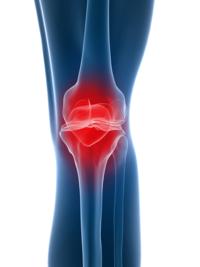 4 главных причины, по которым болят коленные суставы